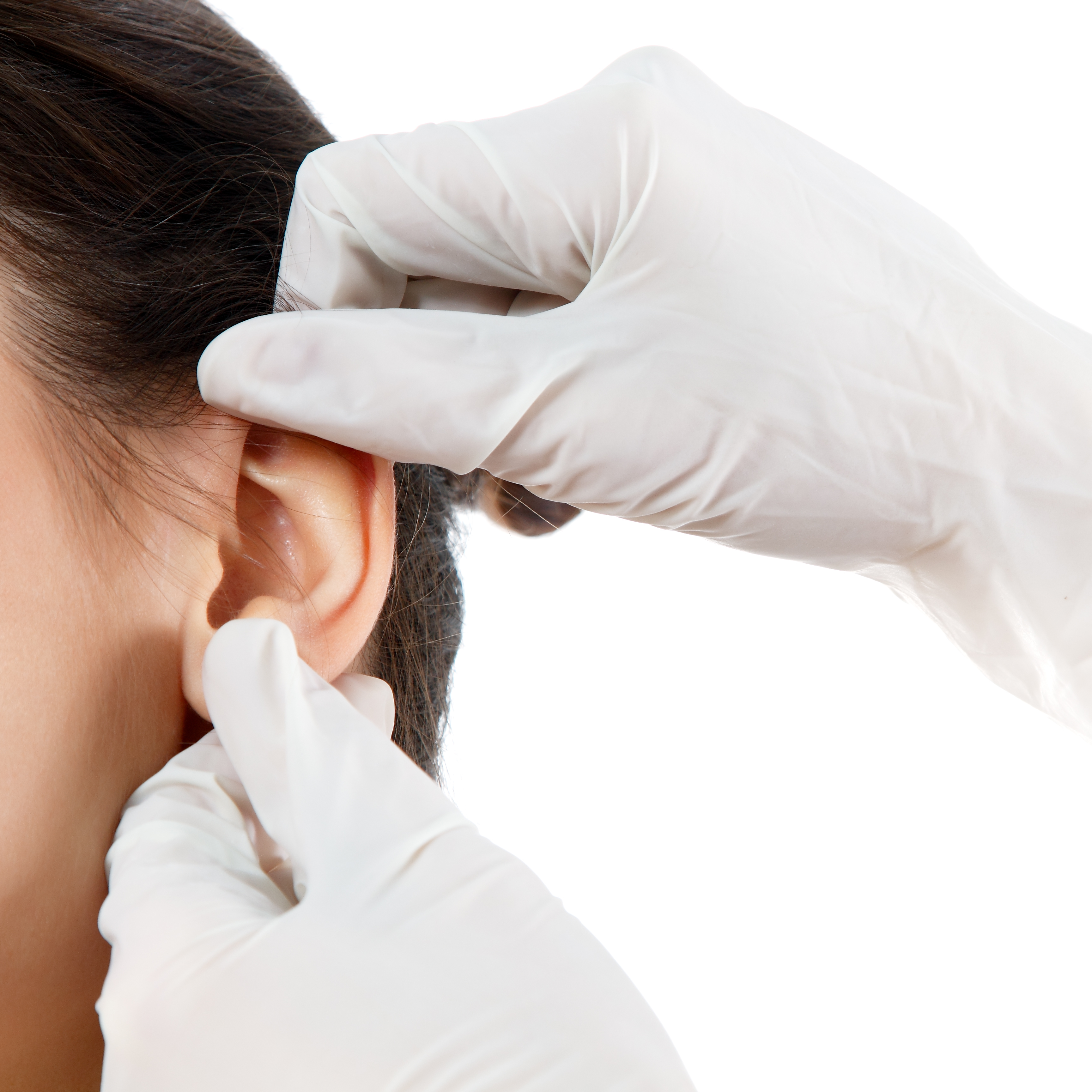 La cirugía de orejas devuelve la apariencia natural y armónica a esta parte de la cara.